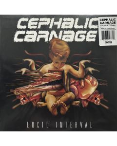 Lucid Interval