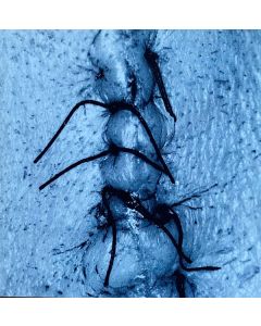 Infliction