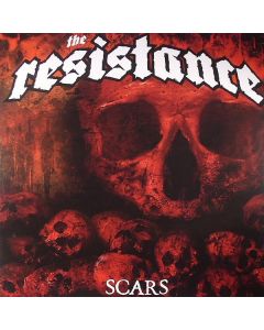 Scars