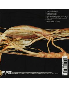 Transfer Trachea Reverberations From Point: False Omniscient